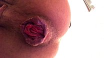sex 22летняя пролапс бутона розы cu arrombado с разбитой дырой анальная свинья экстремальный хардкорный фетиш porn