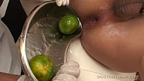 sex извращенные медицинские фетиши азиатки не играющие в гольф porn