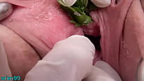 sex analfest nettles in peehole urethral insertion nettles fisting cunt porn