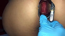 sex еще один день осмотра задницы сучки изнутри в результате получилась широко открытая и рыхлая дырочка и мне нравится porn