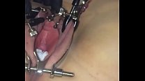 sex б уретра женская t porn